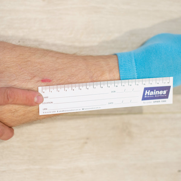 Medical Wound Ruler - Recyclable Paper - Haines Medical Australia